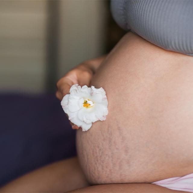 Jak powstają rozstępy w ciąży i jak im zapobiegać?